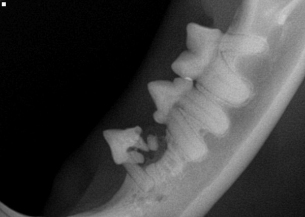 dental x-ray